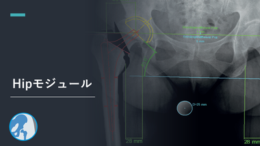 整形外科2Dデジタルプランニングツール 『mediCAD Classic』 