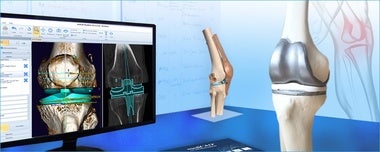 整形外科3Dデジタルプランニングツール 『mediCAD Knee 3D』 Knee3D