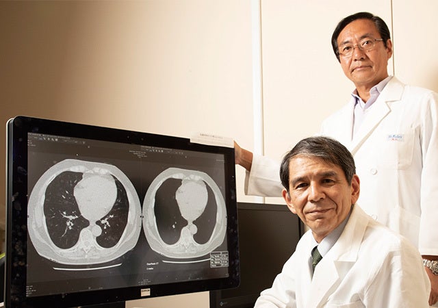 肺がんの早期発見を補助　過酷な業務に携わる医師を助ける最先端画像処理技術