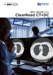 胸部CT読影支援システム ClearRead CT+DC