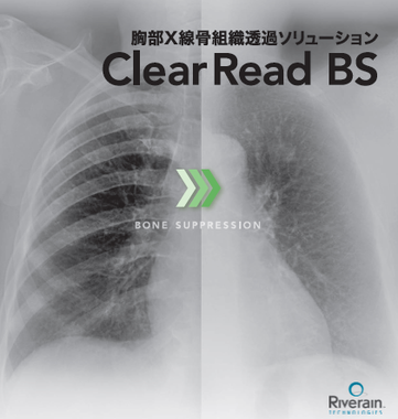 ClearRead BS