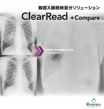 ClearRead +Compare